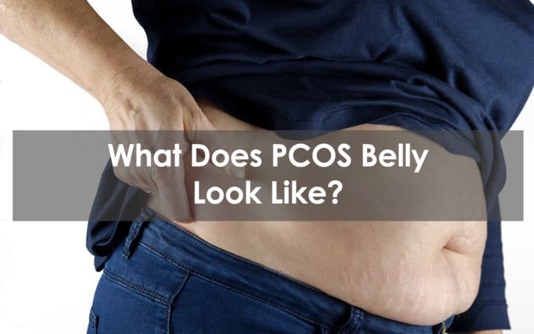what does pcos belly look like